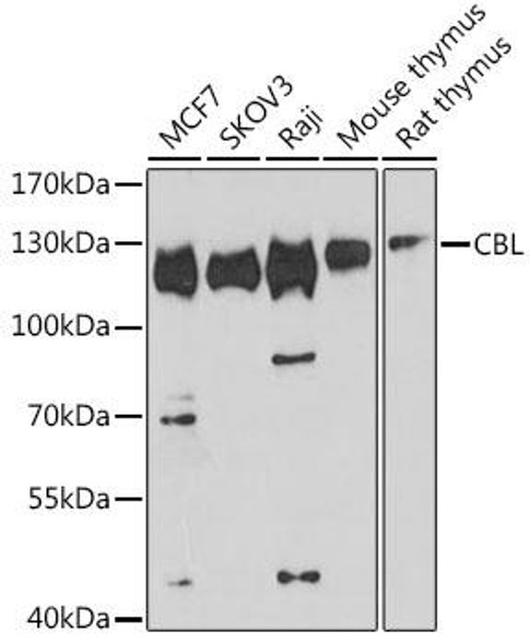 CBL Rabbit Polyclonal Antibody (CAB0732)
