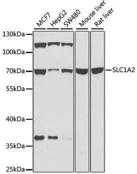 EAAT2/SLC1A2 Rabbit Polyclonal Antibody (CAB0910)