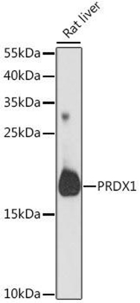 Anti-PRDX1 Antibody (CAB16412)