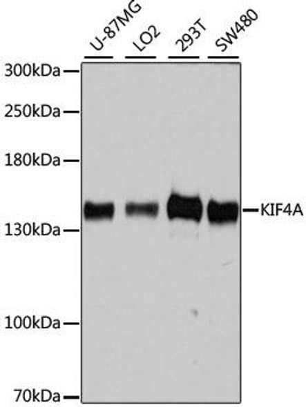 KIF4A Rabbit Polyclonal Antibody (CAB10193)