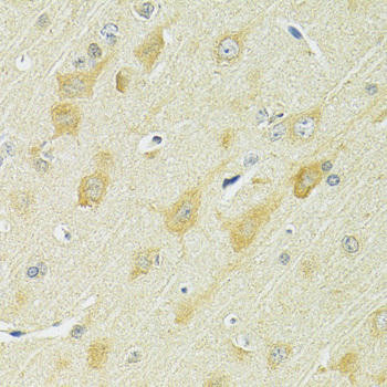 SLC25A1 Rabbit Polyclonal Antibody (CAB10247)