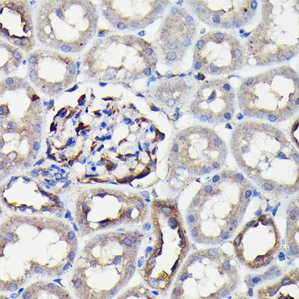 Anti-MYH9 Antibody (CAB16923)