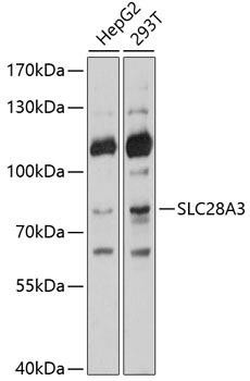 SLC28A3 Rabbit Polyclonal Antibody (CAB10320)