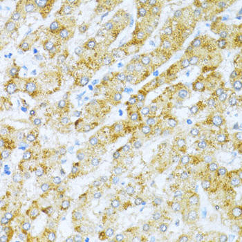 KLHL42 Rabbit Polyclonal Antibody (CAB10373)