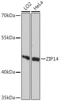 ZIP14 Rabbit Polyclonal Antibody (CAB10413)