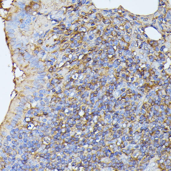 STK24 Rabbit Polyclonal Antibody (CAB10576)