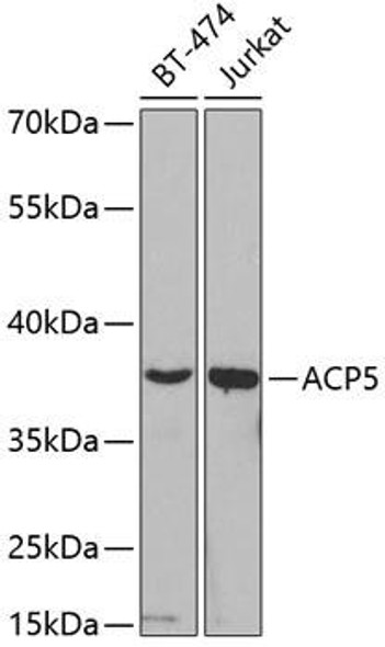 Anti-ACP5 Antibody (CAB2528)