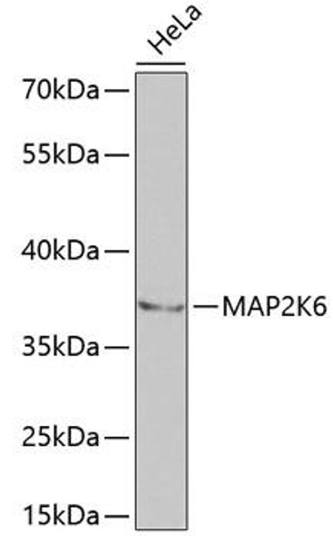 Anti-MAP2K6 Antibody (CAB2575)