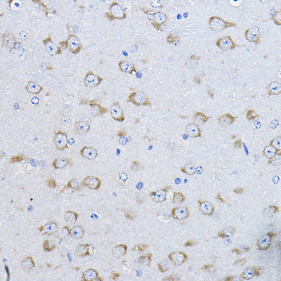 FAK Rabbit Polyclonal Antibody (CAB11531)