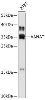 AANAT Rabbit Polyclonal Antibody (CAB11850)