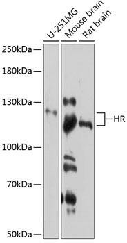 HR Rabbit Polyclonal Antibody (CAB11996)