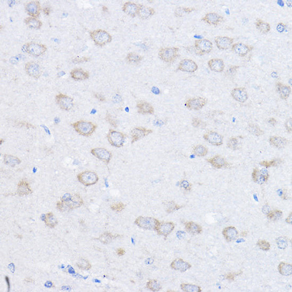 Anti-UBE4A Antibody (CAB3354)