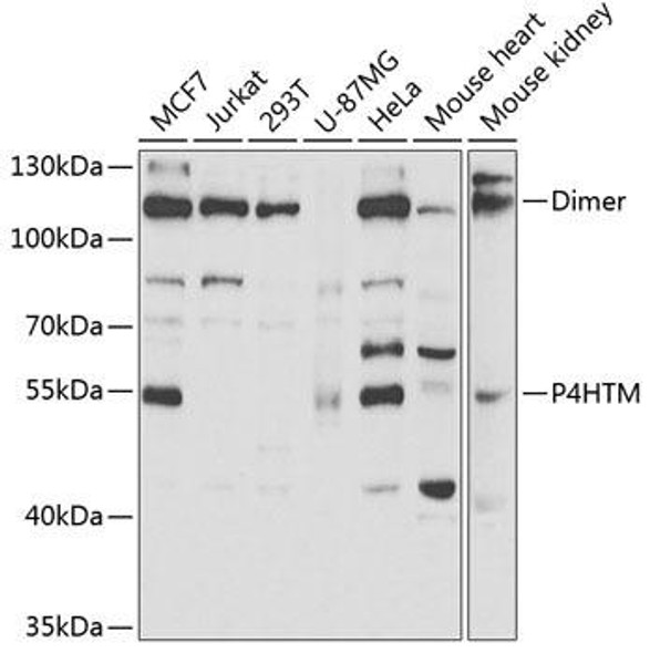 Anti-P4HTM Antibody (CAB6143)