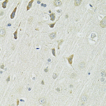 SLC1A4 Rabbit Polyclonal Antibody (CAB12507)