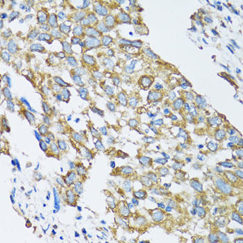 SLC25A13 Rabbit Polyclonal Antibody (CAB12557)
