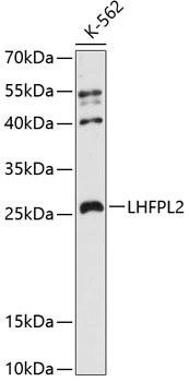 LHFPL2 Rabbit Polyclonal Antibody (CAB12808)