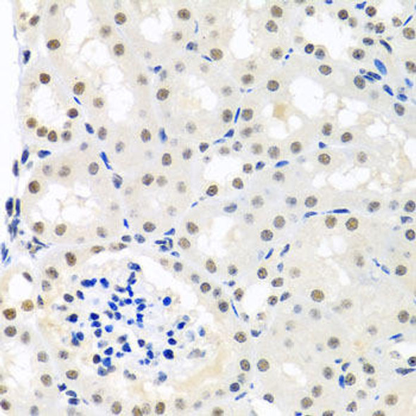 Anti-THOC1 Antibody (CAB8179)