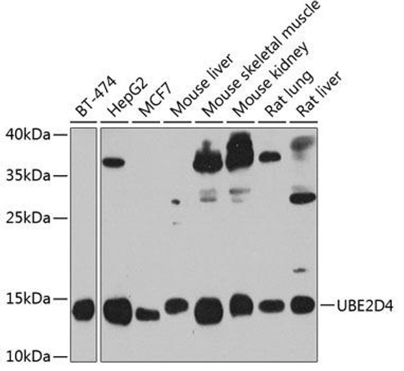 Anti-UBE2D4 Antibody (CAB8332)