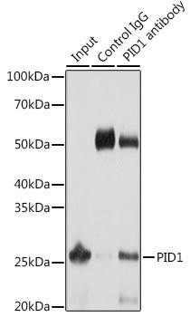 PID1 Rabbit Polyclonal Antibody (CAB13220)