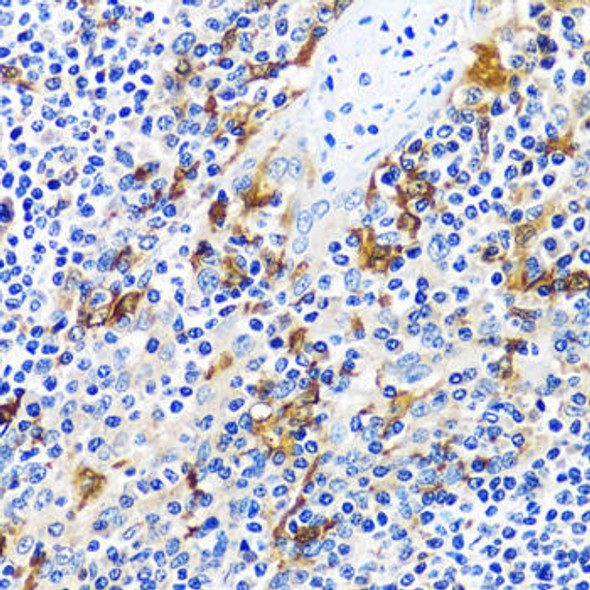 Anti-CASQ1 Antibody (CAB16796)