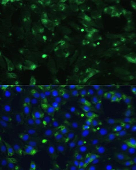 Anti-ENO1 Antibody (CAB16841)