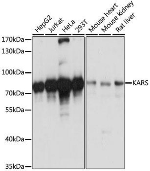 LysRS/KARS Rabbit Polyclonal Antibody (CAB13772)