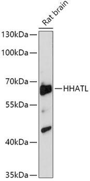 Anti-HHATL Antibody (CAB17739)