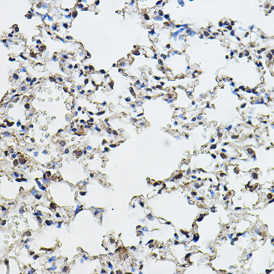 Cyclin E1 Rabbit Polyclonal Antibody (CAB14225)