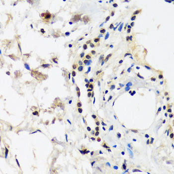 CAND1 Rabbit Polyclonal Antibody (CAB14287)