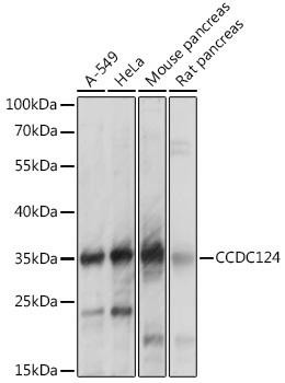CCDC124 Rabbit Polyclonal Antibody (CAB14298)