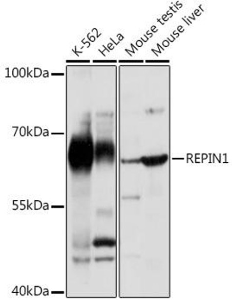 Anti-REPIN1 Antibody (CAB18451)