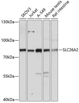 SLC26A2 Rabbit Polyclonal Antibody (CAB14561)