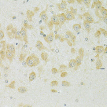 SLC37A4 Rabbit Polyclonal Antibody (CAB14564)