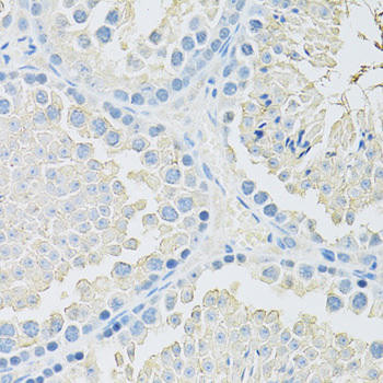 SLC2A9 Rabbit Polyclonal Antibody (CAB14606)