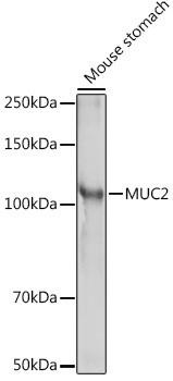 MUC2 Rabbit Polyclonal Antibody (CAB14659)