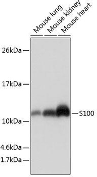 Anti-S100 Antibody (CAB19107)