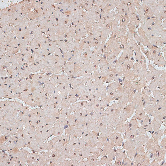 TLK1 Rabbit Polyclonal Antibody (CAB14831)