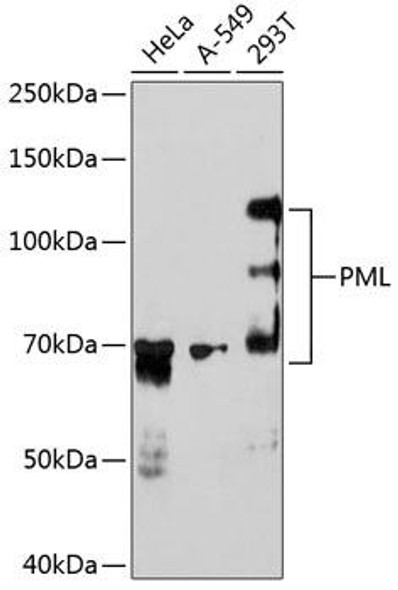 Anti-PML Antibody (CAB19646)