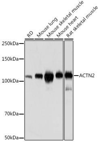 Anti-ACTN2 Antibody (CAB8939)