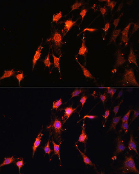 PRR5 Rabbit Polyclonal Antibody (CAB15170)