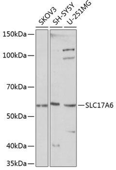 SLC17A6 Rabbit Polyclonal Antibody (CAB15177)