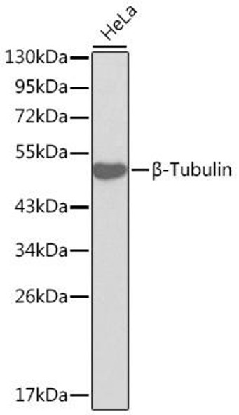 Anti-Beta-Tubulin Antibody (CAB0482)