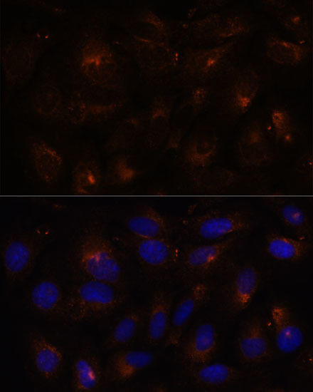 ESYT1 Rabbit Polyclonal Antibody (CAB15410)
