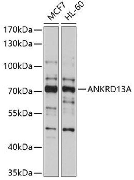 Anti-ANKRD13A Antibody (CAB10416)