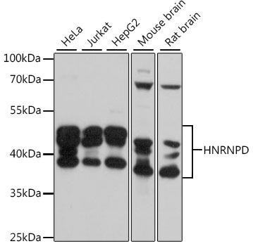 HNRNPD Rabbit Polyclonal Antibody (CAB15679)