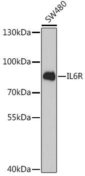 IL6R Rabbit Polyclonal Antibody (CAB1570)