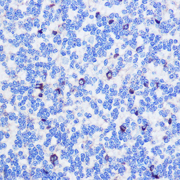 Anti-ASC / TMS1 Antibody (CAB11433)