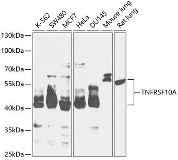 Anti-TNFRSF10A Antibody (CAB12540)