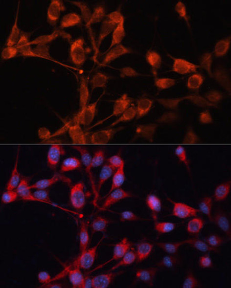 Anti-SLC25A19 Antibody (CAB12727)