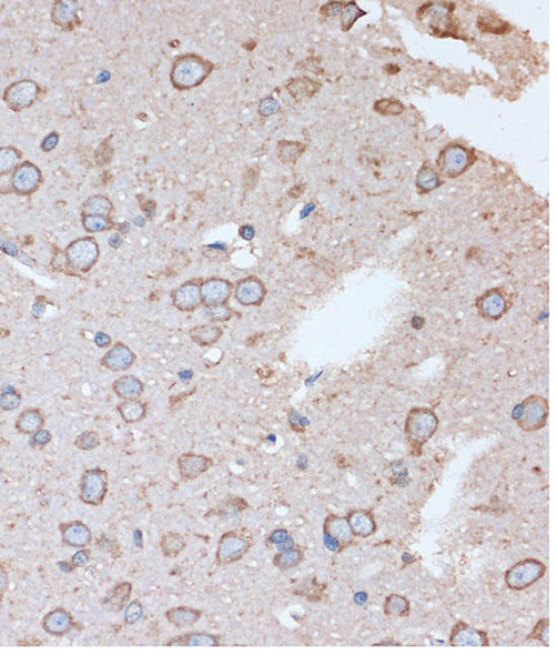 OR2S2 Rabbit Polyclonal Antibody (CAB16136)